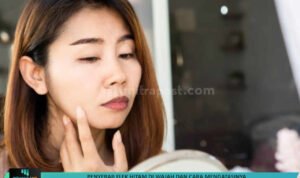 Penyebab Flek Hitam di Wajah dan Cara Mengatasinya