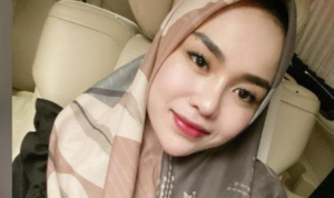 Medina Zein Foto Lebam dan Sebut Suami Pengecut