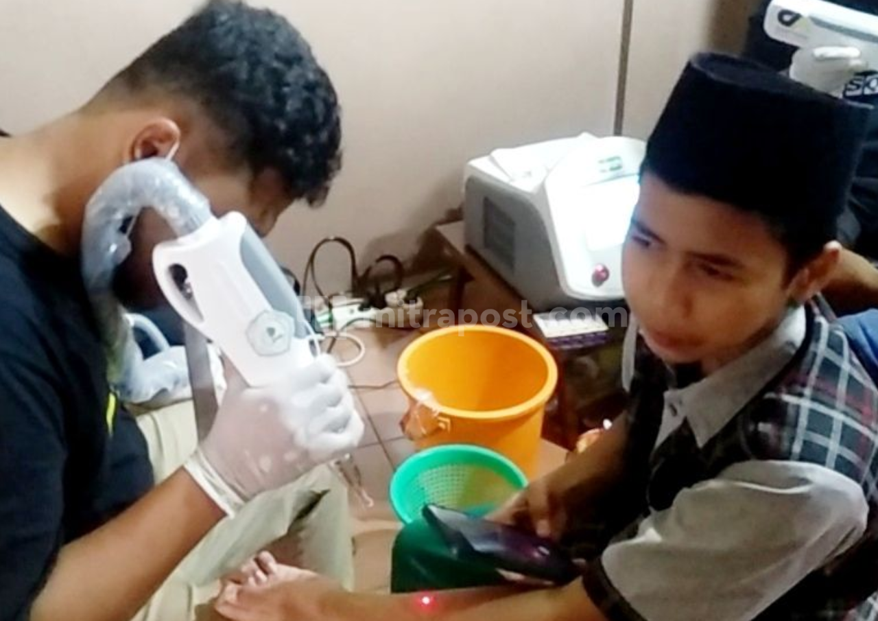 Anak 14 Tahun Asal Margoyoso Ikuti Acara Hapus Tattoo Gratis