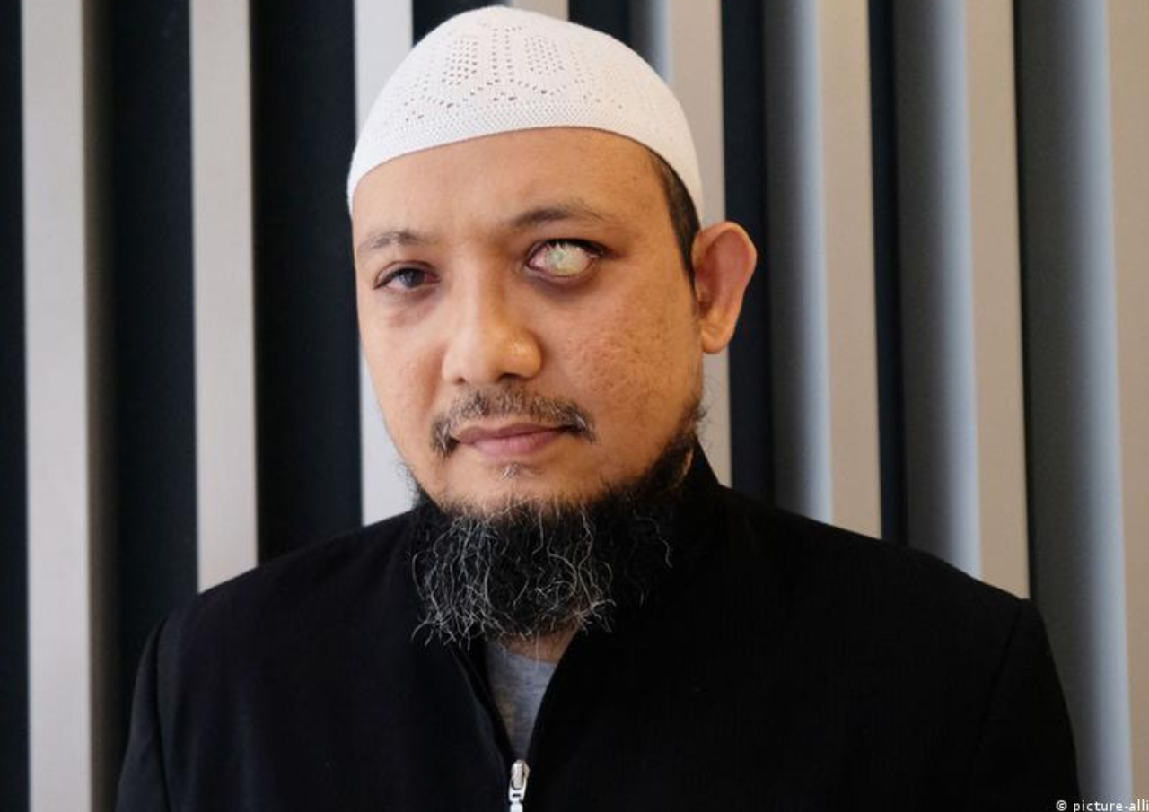 Mata Kiri Novel Baswedan Buta Permanen