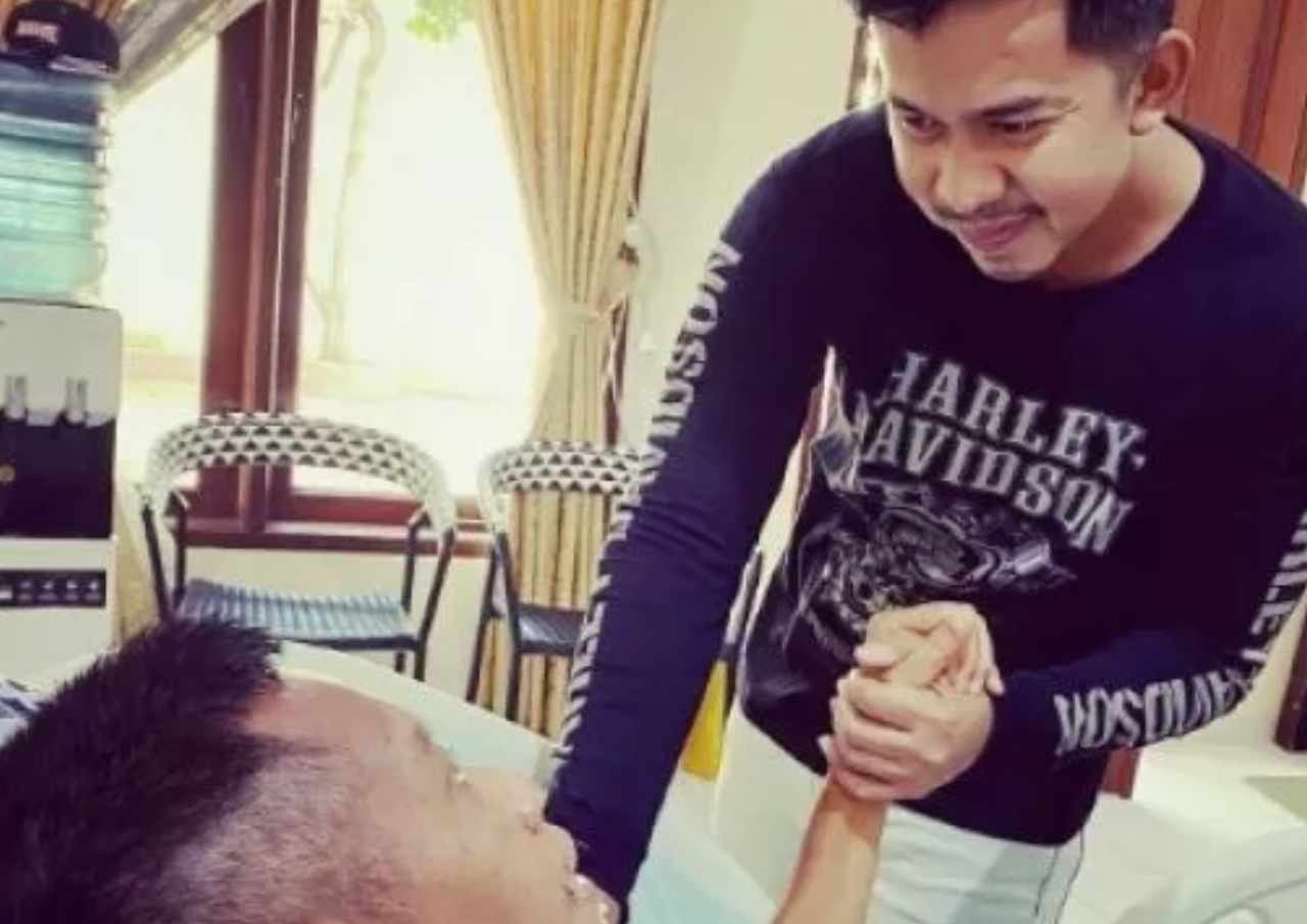 Kondisi Tukul Arwana setelah Pendarahan Otak