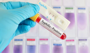 Kasus Sifilis Meningkat, Waspada Tanda-Tanda Berikut/ iStock