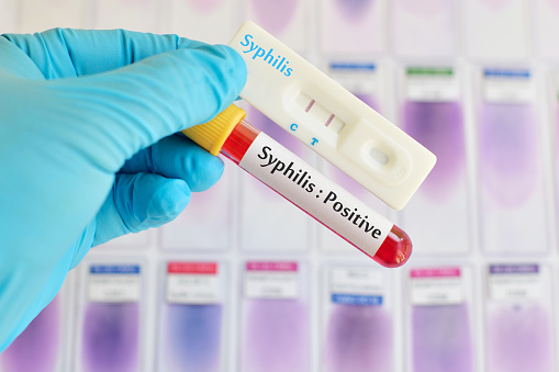 Kasus Sifilis Meningkat, Waspada Tanda-Tanda Berikut/ iStock