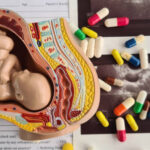 Foto: Ilustrasi praktik aborsi (Sumber: iStock)