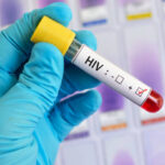 Foto: Ilustrasi HIV/AIDS (Sumber: istock)