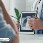 Apa Itu Pneumonia Bilateral yang Sempat Diderita Paus Fransiskus?