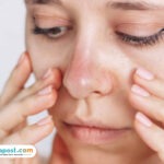 Tips Meminimalkan Efek Purging Setelah Menggunakan Skincare Baru