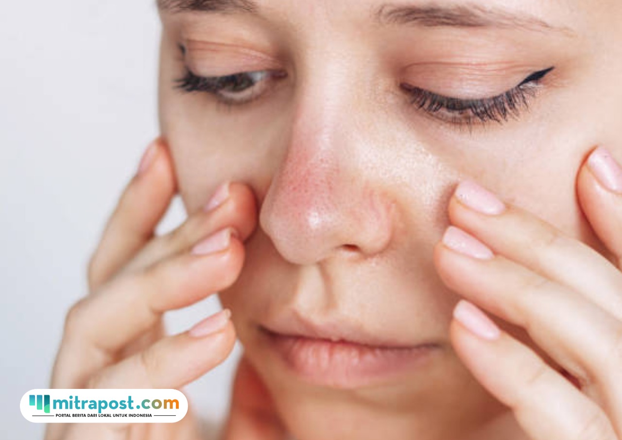 Tips Meminimalkan Efek Purging Setelah Menggunakan Skincare Baru